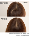 Scalp Hair Essence (Promotes Hair Growth)