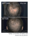 Scalp Hair Essence (Promotes Hair Growth)
