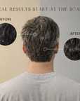 Scalp Conditioner