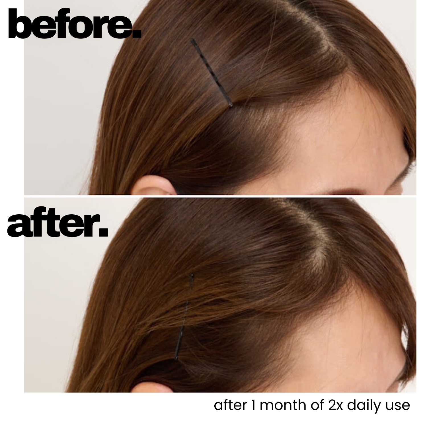 Scalp Hair Essence (Promotes Hair Growth)