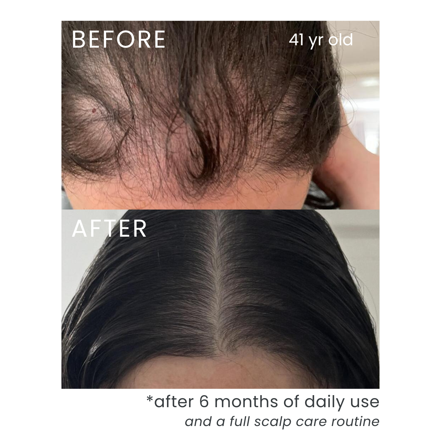 Scalp Hair Essence (Promotes Hair Growth)